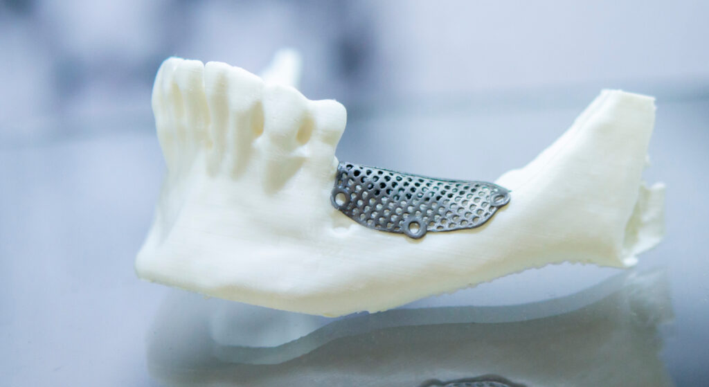 Standards for Shape Memory Alloys: From Actuation Systems to Medical Devices